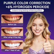 Teeth Whitening Dry Strips